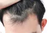 Hair care