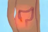 Appendicitis के लिए सर्वश्रेष्ठ घरेलू उपचार : आइए जानते है